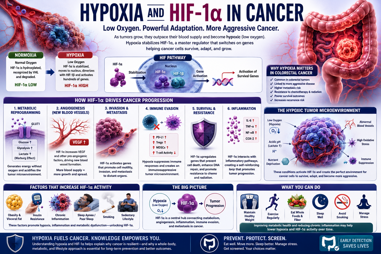 Medical infographic explaining how hypoxia and HIF-1α help colon cancer survive through angiogenesis, immune evasion, inflammation, metabolic adaptation, and tumor progression.